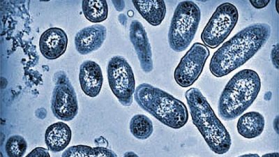 5 Makanan yang Bisa Mengancam Kesehatan Anak dengan Bakteri Salmonella