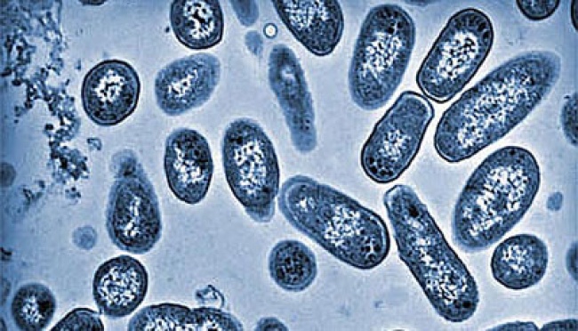 5 Makanan yang Bisa Mengancam Kesehatan Anak dengan Bakteri Salmonella