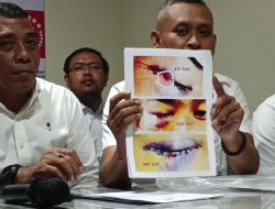 Kasus Kekerasan Siswa Malang Belum Terpecahkan, Orang Tua Menuntut Keadilan Kasus Kekerasan Siswa Malang Belum Terpecahkan, Orang Tua Menuntut Keadilan