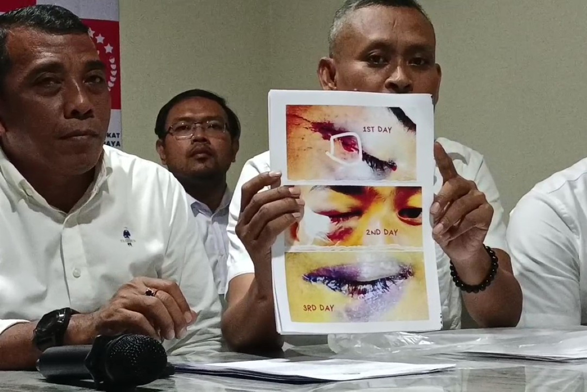 Kasus Kekerasan Siswa Malang Belum Terpecahkan, Orang Tua Menuntut Keadilan