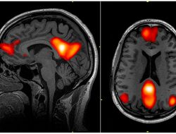 Boredom: The Overlooked Benefit That Science Says Can Be Good for Us