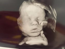 ‘Miracle Revealed: “Hand of God” Appears on Ultrasound After Mom Prays for Baby’