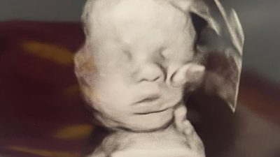 ‘Miracle Revealed: “Hand of God” Appears on Ultrasound After Mom Prays for Baby’