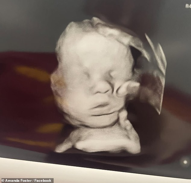 ‘Miracle Revealed: “Hand of God” Appears on Ultrasound After Mom Prays for Baby’