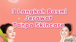 3 Langkah Mudah Basmi Jerawat tanpa Perawatan Rumit