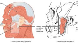 Chew Well, Give Thanks: Simple Tips to Avoid Abdominal Discomfort