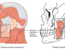 Chew Well, Give Thanks: Simple Tips to Avoid Abdominal Discomfort
