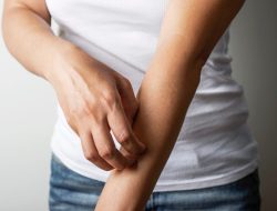 Hives vs. Rash: Learn to Spot the Difference
