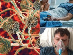Alarm Sounded: Experts Warn Lethal Fungus Poses “Existential Threat” to Humanity – International Edition (English) Alarm Sounded: Experts Warn Lethal Fungus Poses “Existential Threat” to Humanity – International Edition (English)