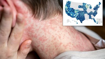 Scary Map Forecasts Surge of World’s Most Contagious Disease in These U.S. Counties – International Edition (English)