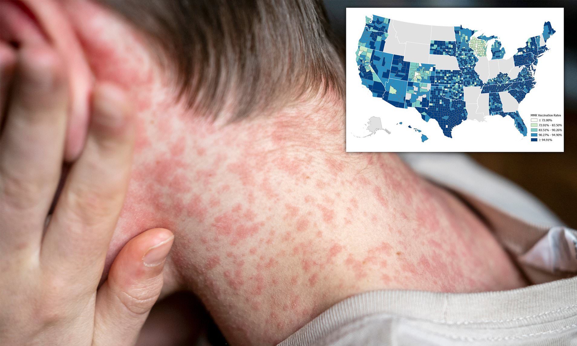 Scary Map Forecasts Surge of World’s Most Contagious Disease in These U.S. Counties – International Edition (English)