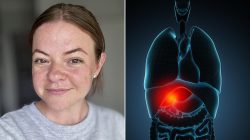 Alarm Raised on Popular Drink After Mother-of-Two Suffers Organ Damage From Daily Habit