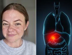 Alarm Raised on Popular Drink After Mother-of-Two Suffers Organ Damage From Daily Habit