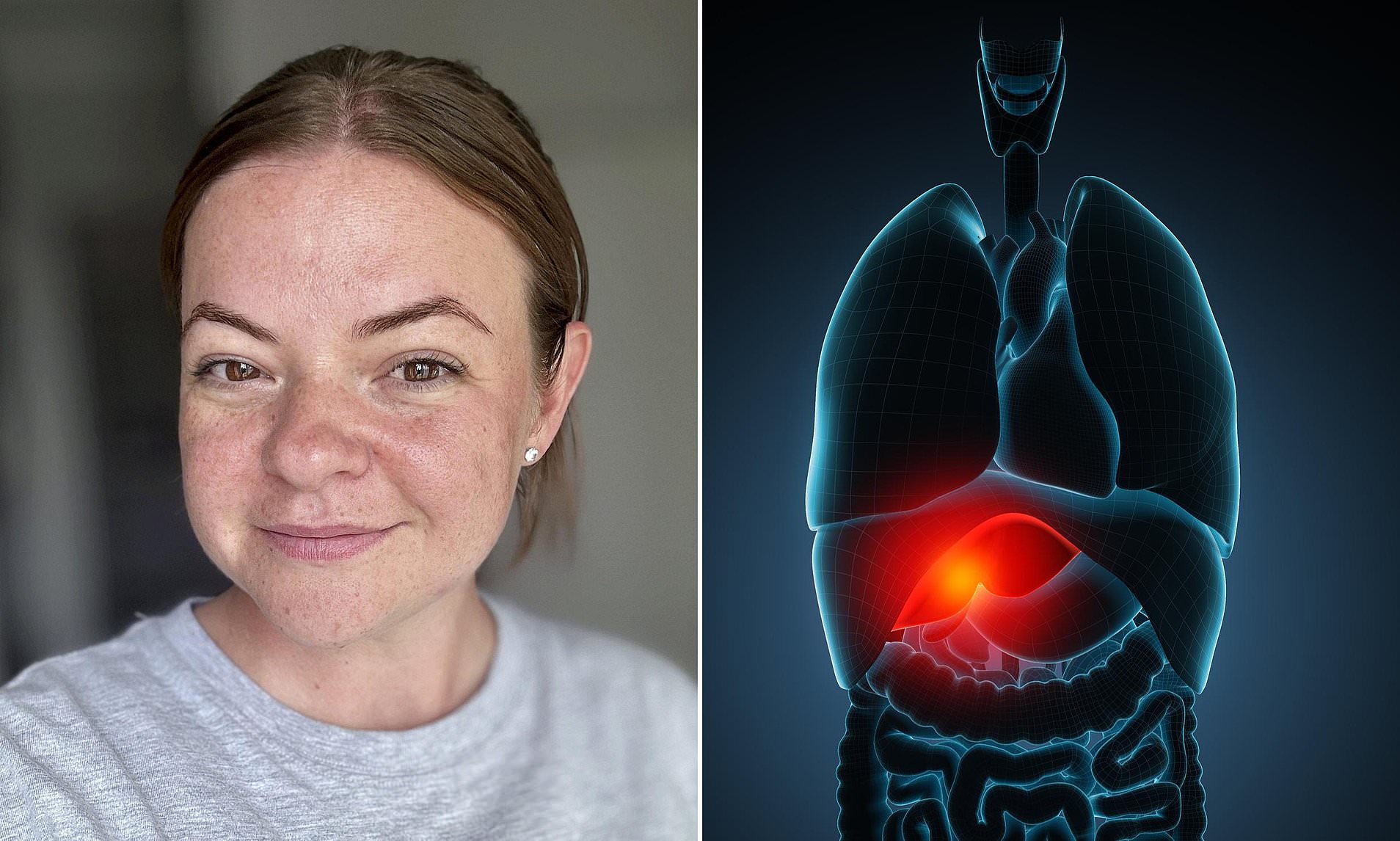 Alarm Raised on Popular Drink After Mother-of-Two Suffers Organ Damage From Daily Habit