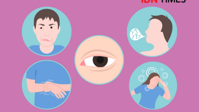 Mengapa Stroke Mengubah Wajah Anda?