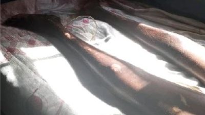 Trapped and Abandoned: The Heart-Wrenching Tale of a Ex-Driver’s Life-Altering Injury After Stray Cow Incident