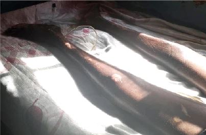 Trapped and Abandoned: The Heart-Wrenching Tale of a Ex-Driver’s Life-Altering Injury After Stray Cow Incident