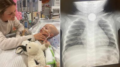 Toddler Swallows Button Battery; Mom Reveals Two-Year Recovery Struggle as Family Endures ‘Torturous’ Journey (Exclusive)