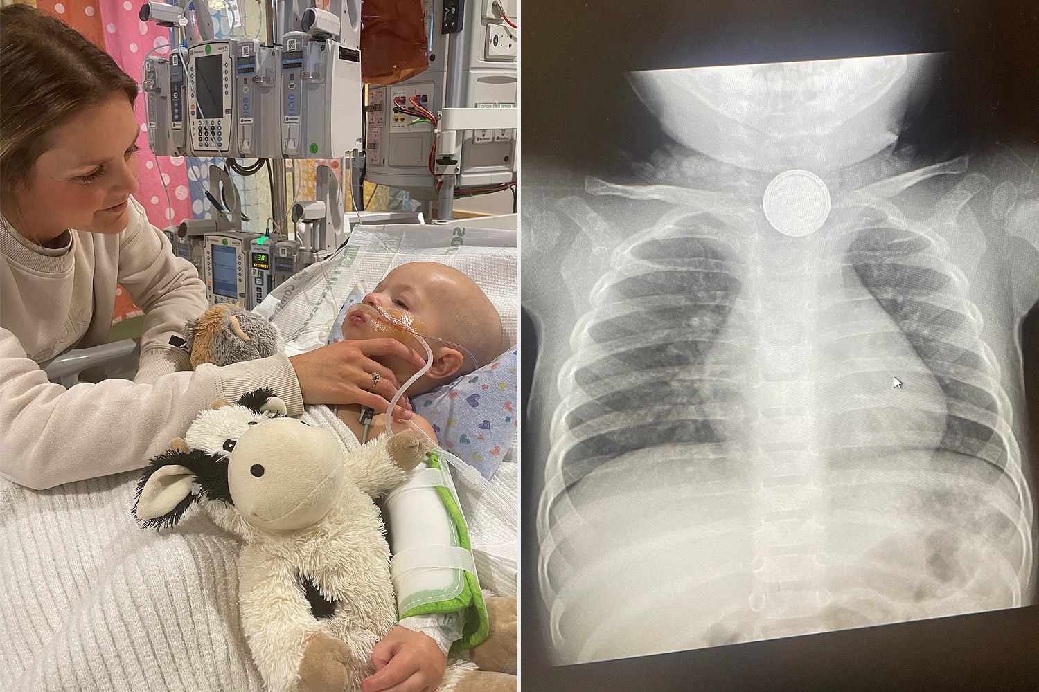 Toddler Swallows Button Battery; Mom Reveals Two-Year Recovery Struggle as Family Endures ‘Torturous’ Journey (Exclusive)
