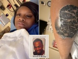 Nearly Died From a Tattoo Mishap? My Cautionary Tale