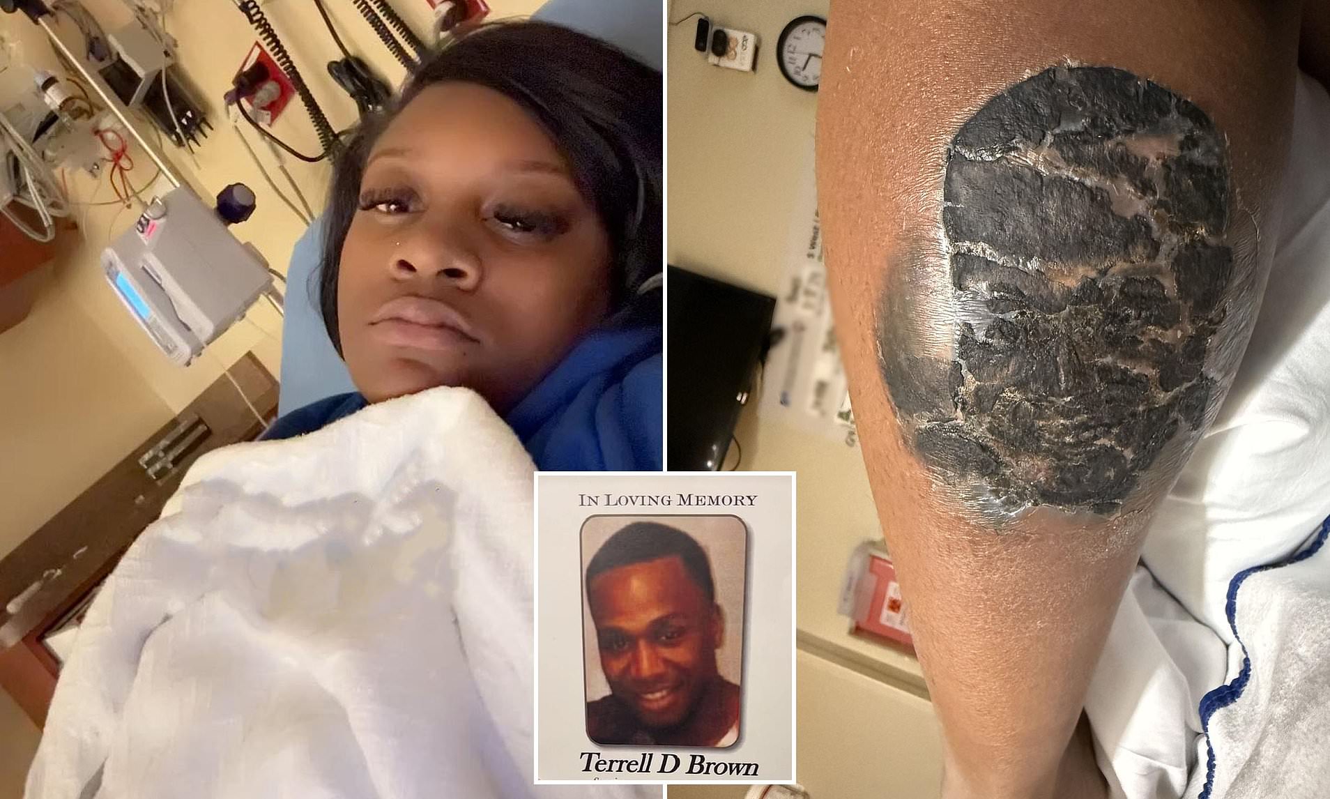 Nearly Died From a Tattoo Mishap? My Cautionary Tale