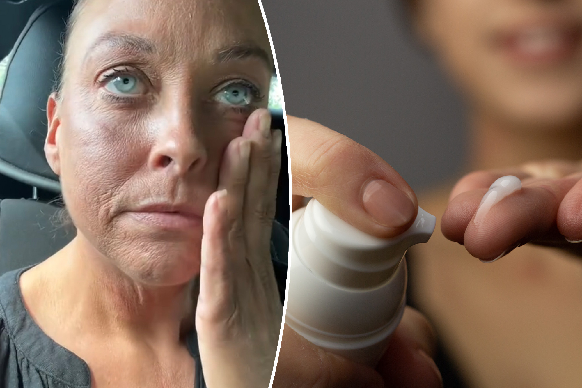Skincare Alert: Popular Product Leaves User Wrinkled and Aged Beyond Recognition