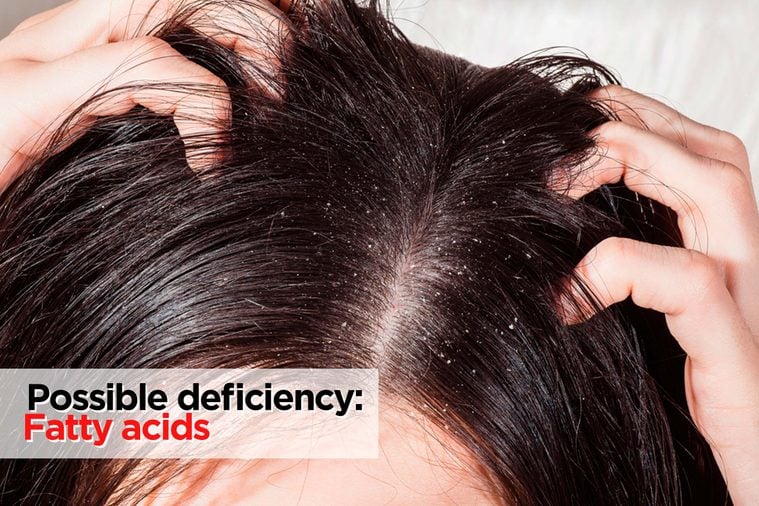 10 Sneaky Signs You’re Missing Out on Essential Vitamins