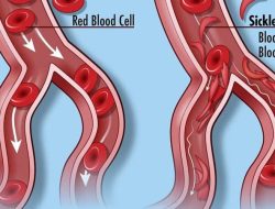 Adekunle Gold Launches Free Health Insurance for Sickle Cell Patients: An International Edition Exclusive