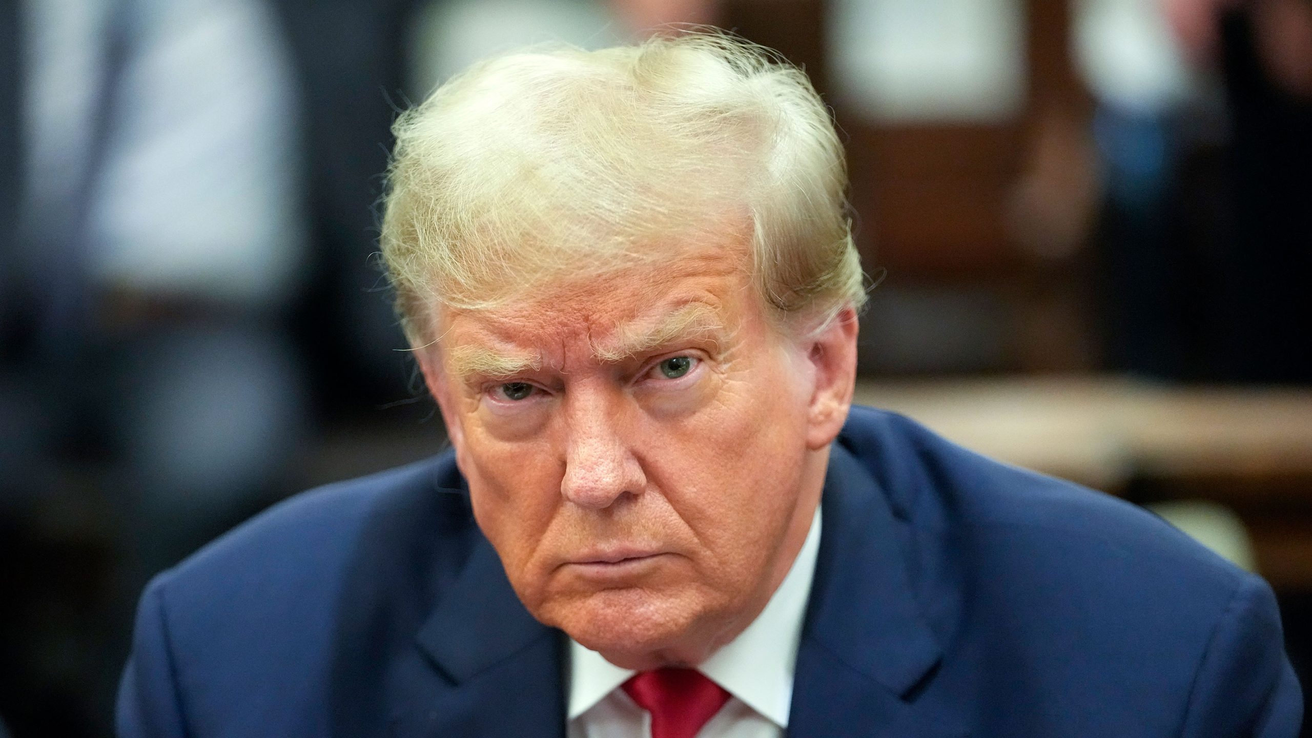 Trump’s Swollen Ankles and Bruised Hands: White House Reveals Health Details