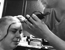 Breakthrough method fights chemotherapy hair loss