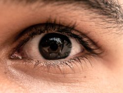Mata Kanan Dewi Yull Tidak Bisa Melihat, Ini Penyebab Ablasio Retina