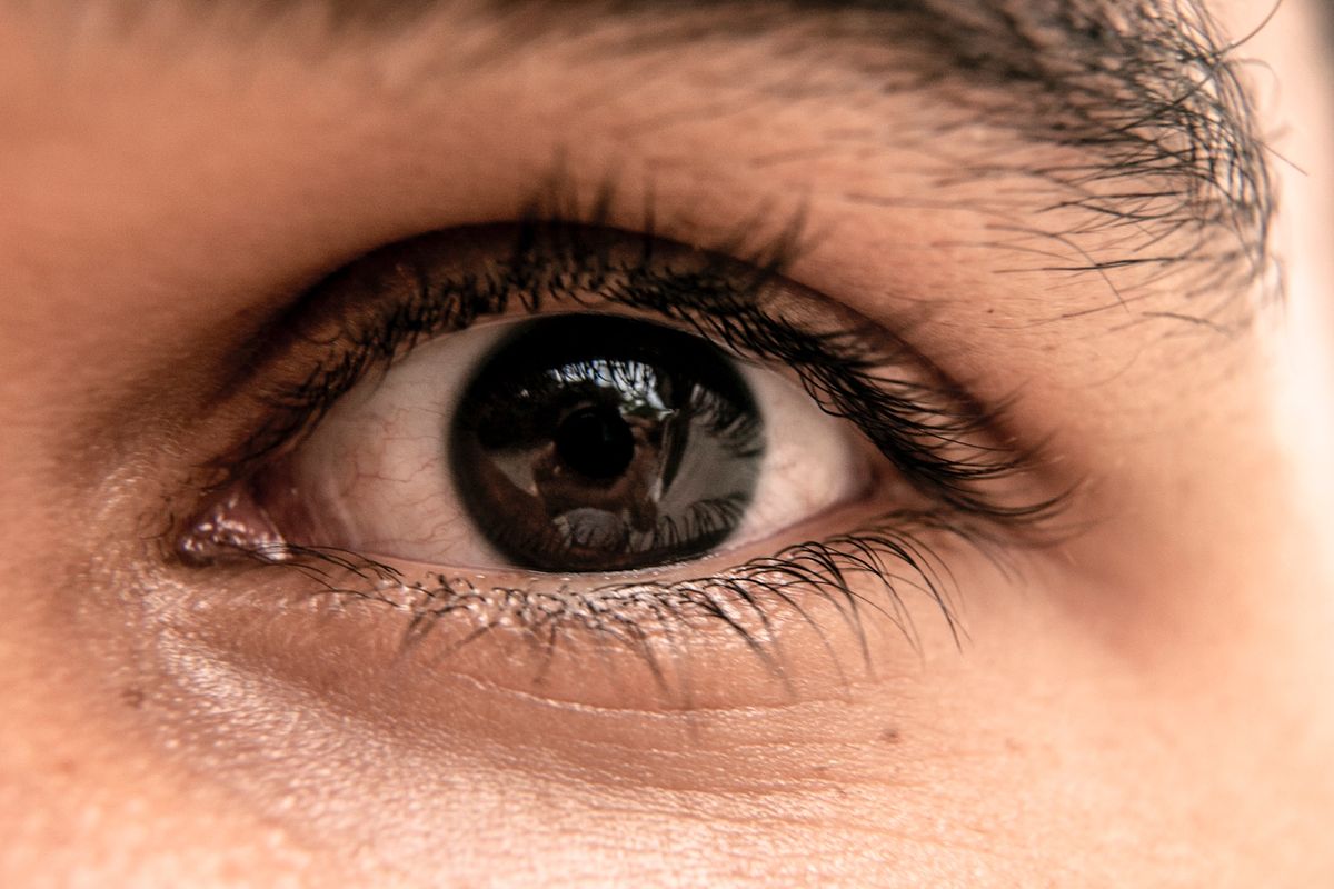 Mata Kanan Dewi Yull Tidak Bisa Melihat, Ini Penyebab Ablasio Retina