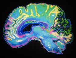 Virginia Tech scientists investigate creatine’s brain benefits Virginia Tech scientists investigate creatine’s brain benefits