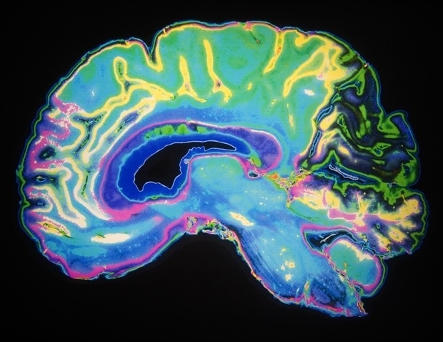 Virginia Tech scientists investigate creatine’s brain benefits