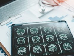 **Rephrased Title:**
*Study Reveals Stark Regional Gaps in Dementia Rates Among U.S. Veterans*
Let me know if you’d like alternative versions! **Rephrased Title:**
*Study Reveals Stark Regional Gaps in Dementia Rates Among U.S. Veterans*
Let me know if you’d like alternative versions!