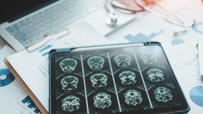 **Rephrased Title:**  
*Study Reveals Stark Regional Gaps in Dementia Rates Among U.S. Veterans*  

Let me know if you’d like alternative versions!