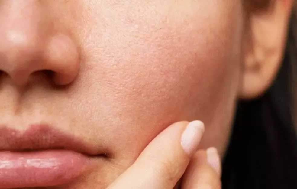 5 Rekomendasi Skincare Ampuh untuk Mengecilkan Pori-pori Wajah