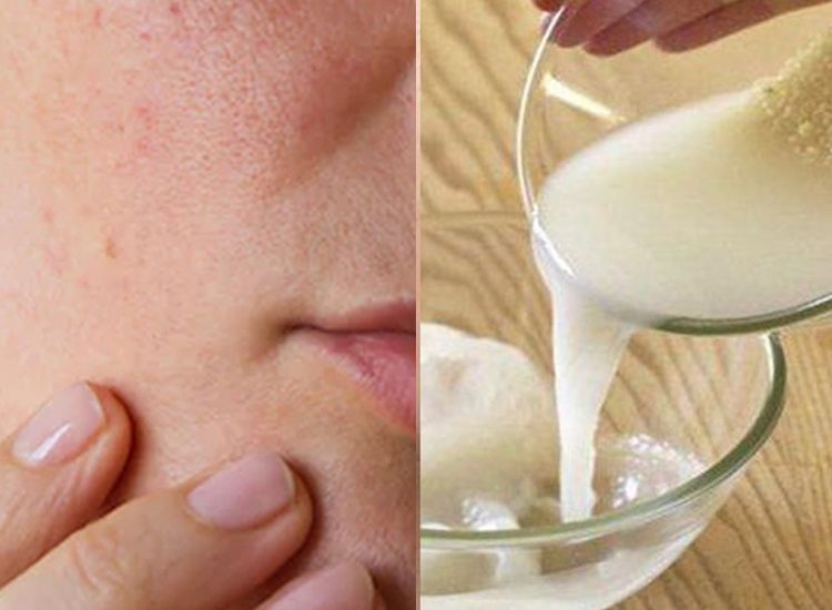 Cara Membuat Masker Beras yang Bikin Wajah Glowing Seketika
