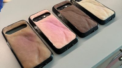 Creepy Phone Case Burns Like Human Skin in UV Light