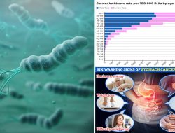 Doctors warn millions face stomach cancer risk from common infection Doctors warn millions face stomach cancer risk from common infection