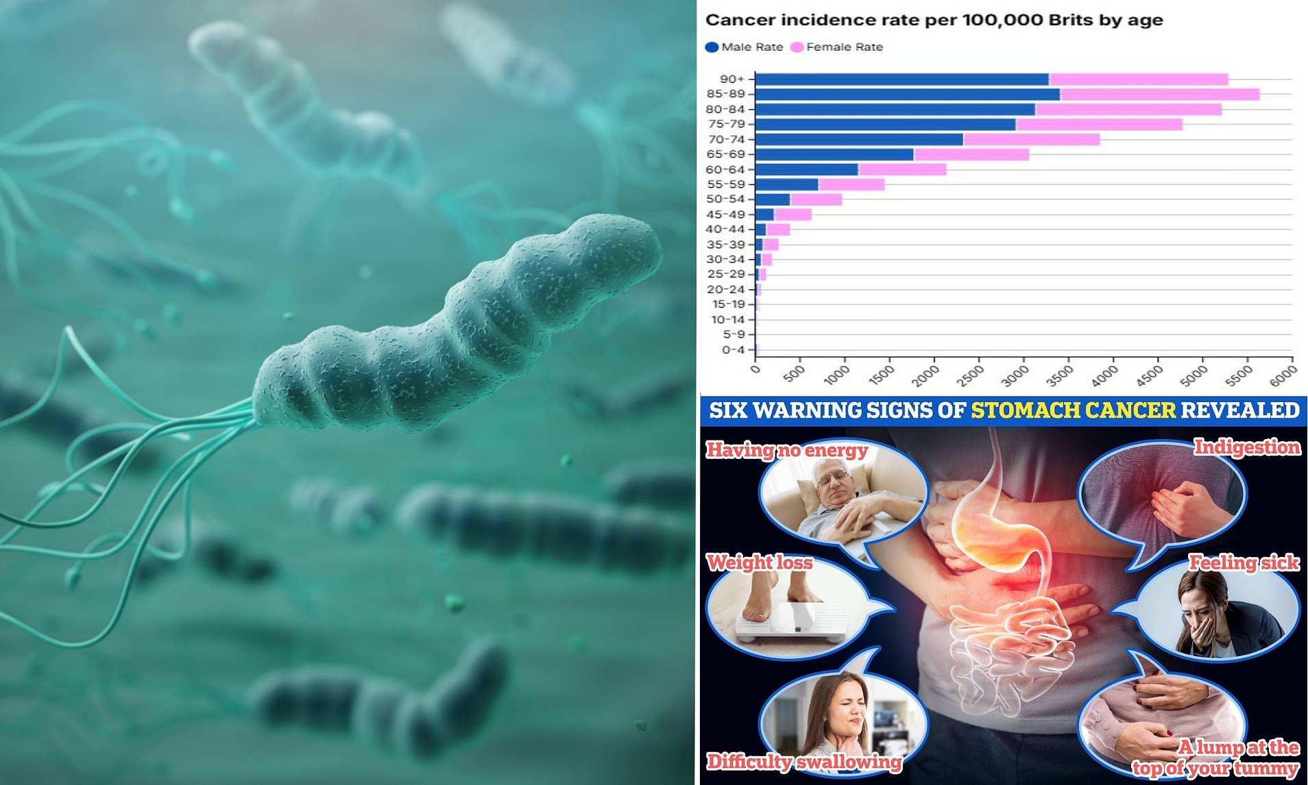 Doctors warn millions face stomach cancer risk from common infection