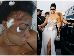Bullet Fragments in Her Brain: Angela Okorie’s Survival Story Bullet Fragments in Her Brain: Angela Okorie’s Survival Story
