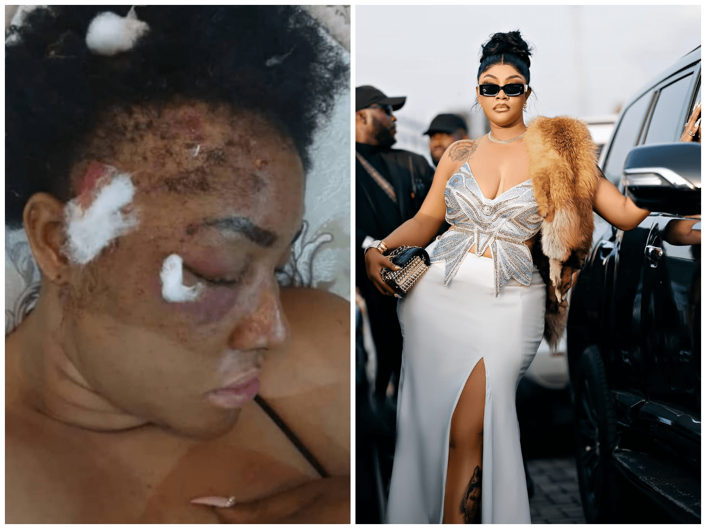 Bullet Fragments in Her Brain: Angela Okorie’s Survival Story