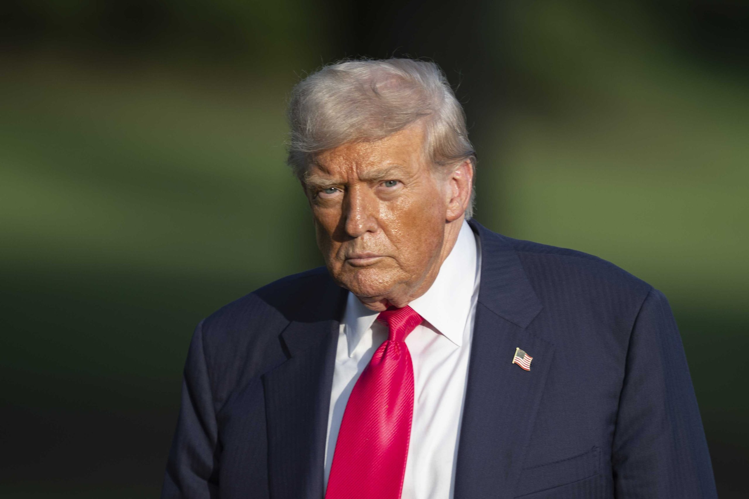 What Is Chronic Venous Insufficiency, the Condition President Trump Has?