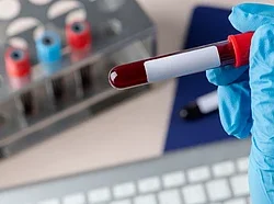 Orissa HC Demands Govt Response on Testing Expansion Delay Orissa HC Demands Govt Response on Testing Expansion Delay