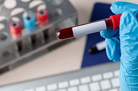 Orissa HC Demands Govt Response on Testing Expansion Delay