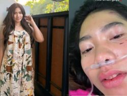 Profil Lusyana Jelita, Pedangdut yang Selamat dari Kecelakaan Maut Profil Lusyana Jelita, Pedangdut yang Selamat dari Kecelakaan Maut