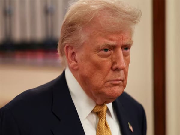 Trump Diagnosed With Common Vein Issue Causing Swelling, White House Says No Serious Health Risks