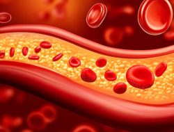 7 Heart-Alerting Signs of High Cholesterol You Can’t Ignore