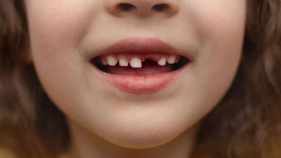 For 20 Years, She Was the Silent Tooth Fairy